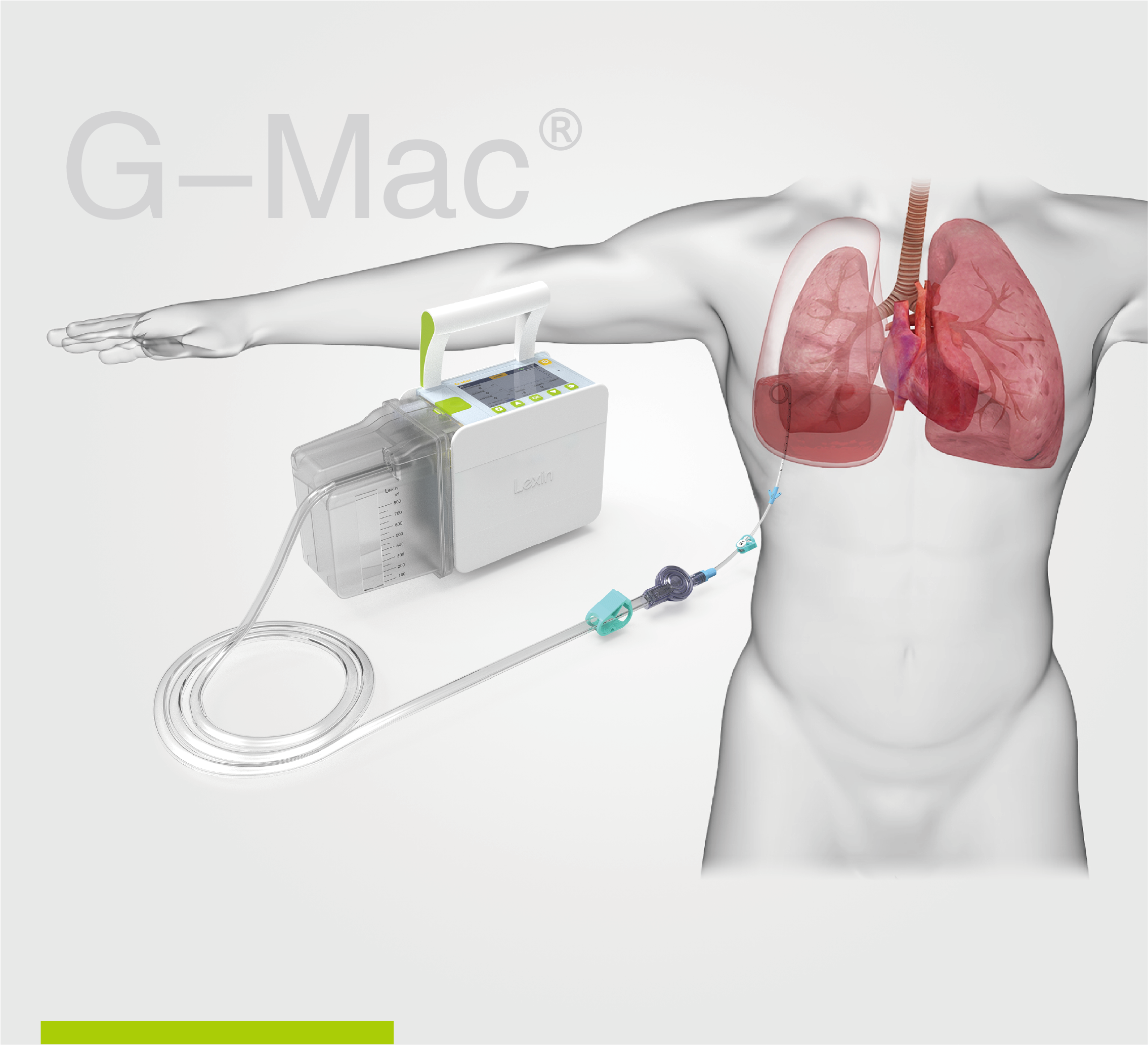 【火热招商】USDT钱包数字化医疗器械(线上)展——第二期·胸腔引流监控系统 G-Mac®